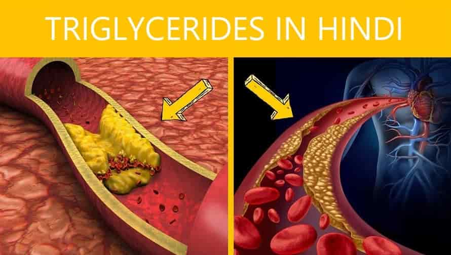 Triglycerides In Hindi लक्षण, कारण, इलाज और दवा