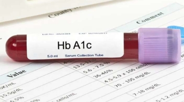 एचबीए1सी टेस्ट क्या है HbA1c Test In Hindi
