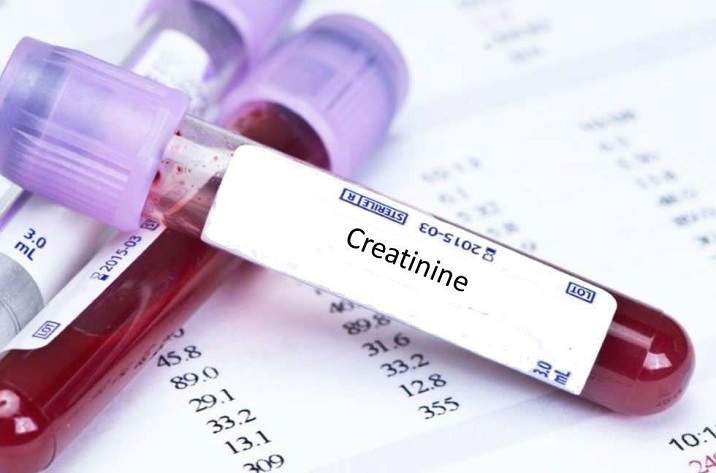 क्रिएटिनिन टेस्ट का परिणाम Creatinine Test Result