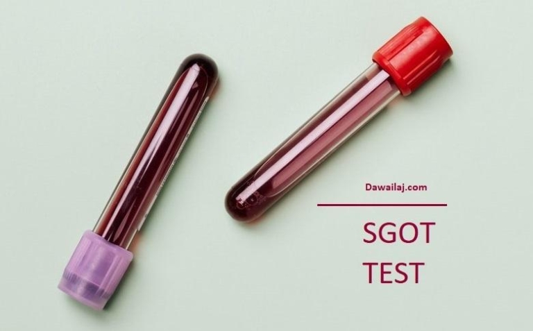 एसजीओटी टेस्ट क्या है, नॉर्मल रेंज, प्रक्रिया SGOT Test In Hindi