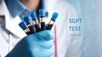 SGPT Test In Hindi लिवर बीमारी में जरुरी एसजीपीटी टेस्ट क्या है