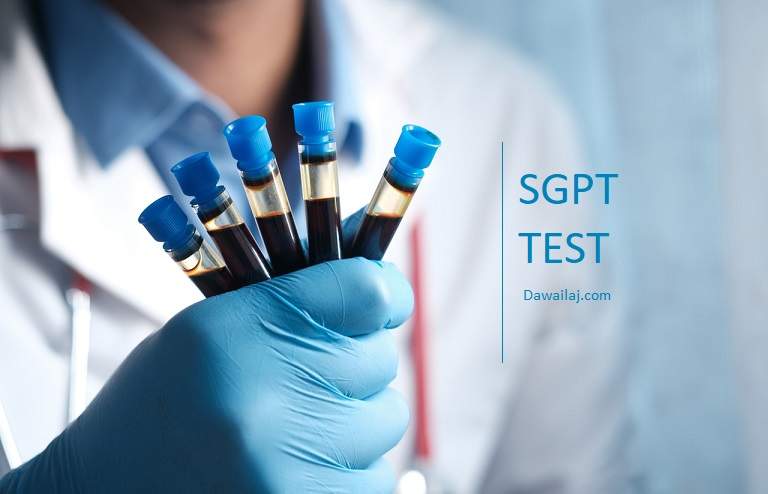 SGPT Test In Hindi लिवर बीमारी में जरुरी एसजीपीटी टेस्ट क्या है